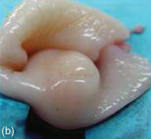 Sheep Artificial Insemination